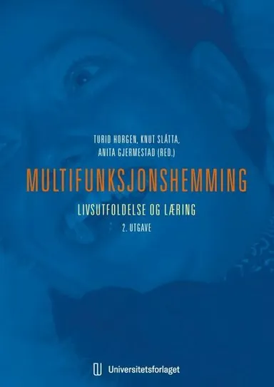 Multifunksjonshemming : livsutfoldelse og læring