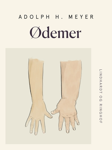 Ødemer