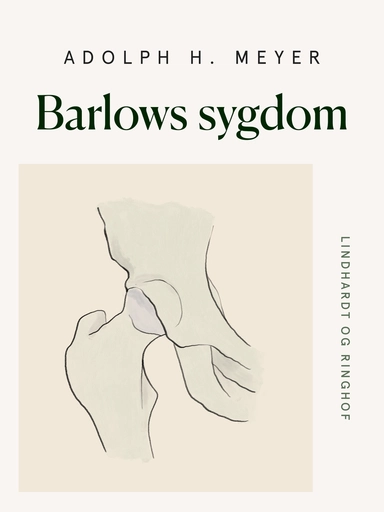 Barlows sygdom