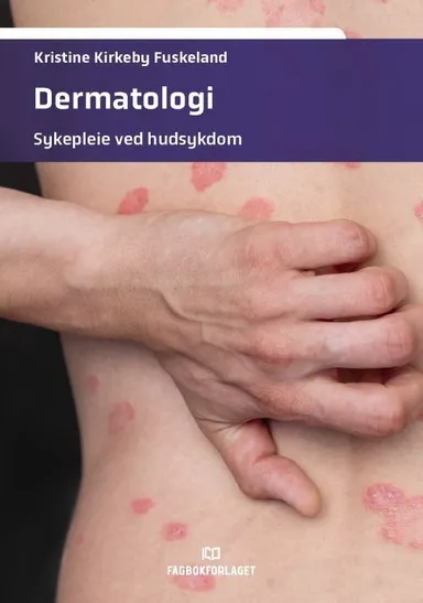 Dermatologi : sykepleie ved hudsykdom