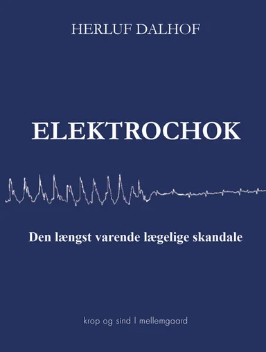 Elektrochok