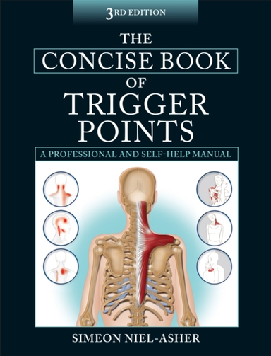 The Concise Book Of Trigger Points