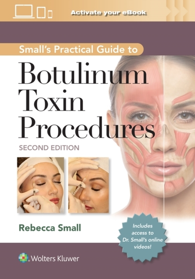 Small'S Practical Guide To Botulinum Toxin Procedures Print
