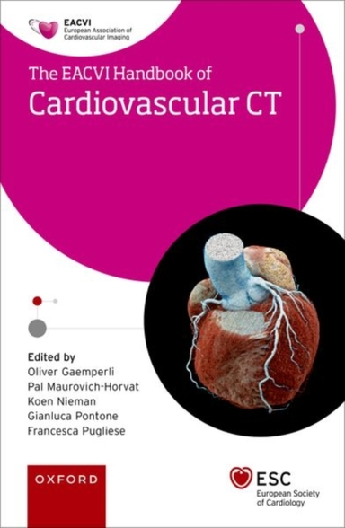 Eacvi Handbook of Cardiovascular Ct