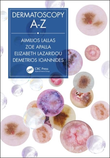 Dermatoscopy A-z