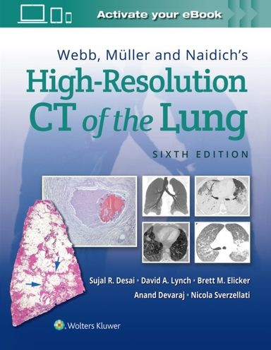 Webb Muller and Naidich's High-resolution Ct of the Lung