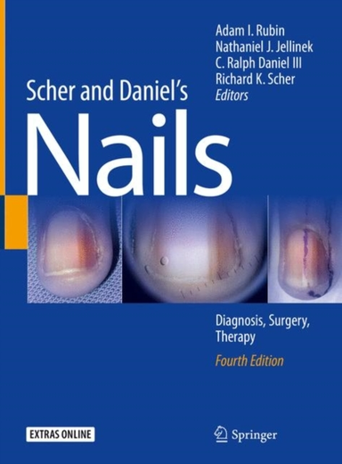 Scher and Daniel's Nailsdiagnosis Surgery Therapy