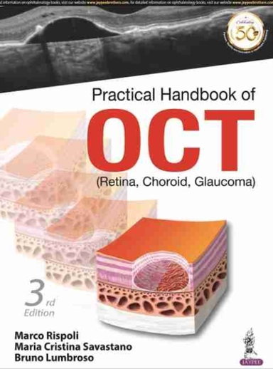 Practical Handbook of Oct(retina Choroid Glaucoma)