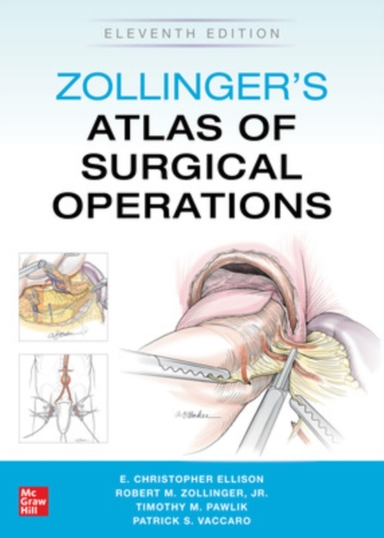 Zollinger's Atlas of Surgical Operations Eleventh Edition