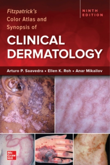 Fitzpatrick's Color Atlas and Synopsis of Clinical Dermatolo