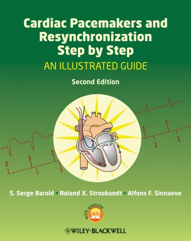 Cardiac Pacemakers and Resynchronization Step by Stepan Illu