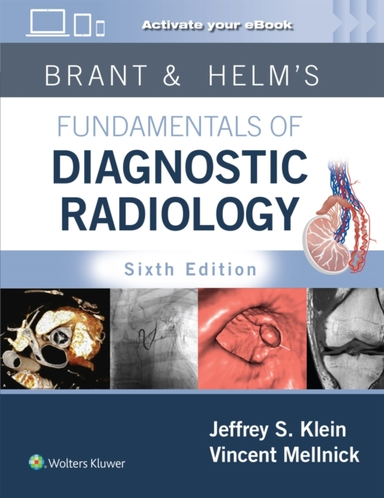 Brant & Helms' Fundamentals of Diagnostic Radiology Print +