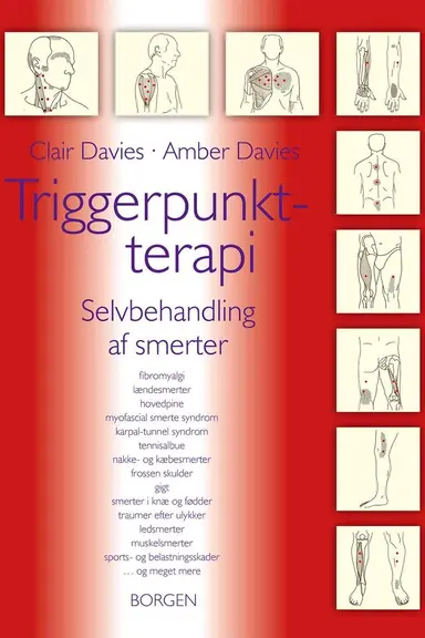 Triggerpunkt-terapi