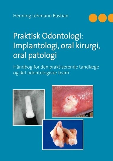 Praktisk Odontologi: Implantologi, oral kirurgi, oral patologi