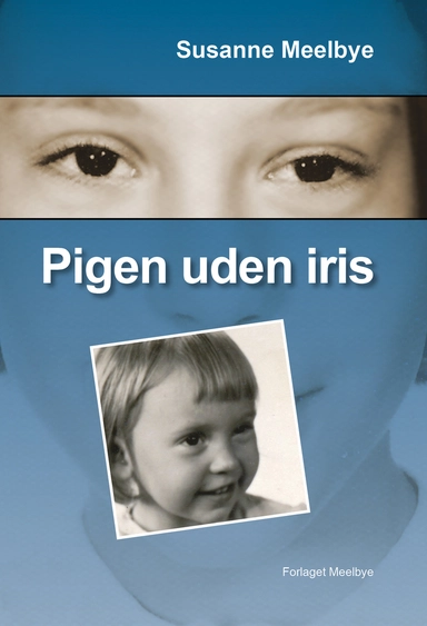 Pigen uden iris